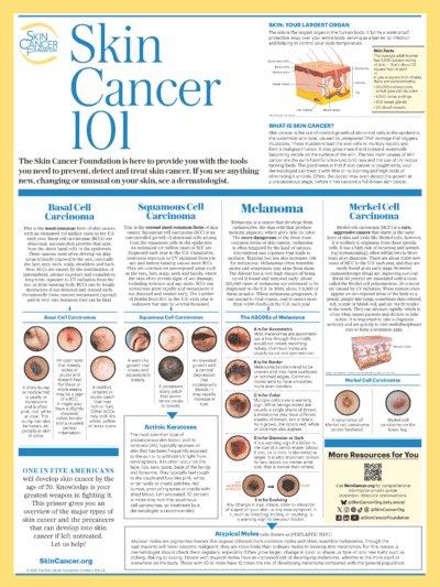 Skin Cancer 101 Poster (18" x 24")