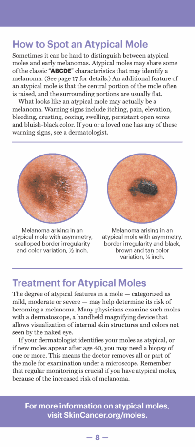 A Guide to Skin Cancers and Precancers