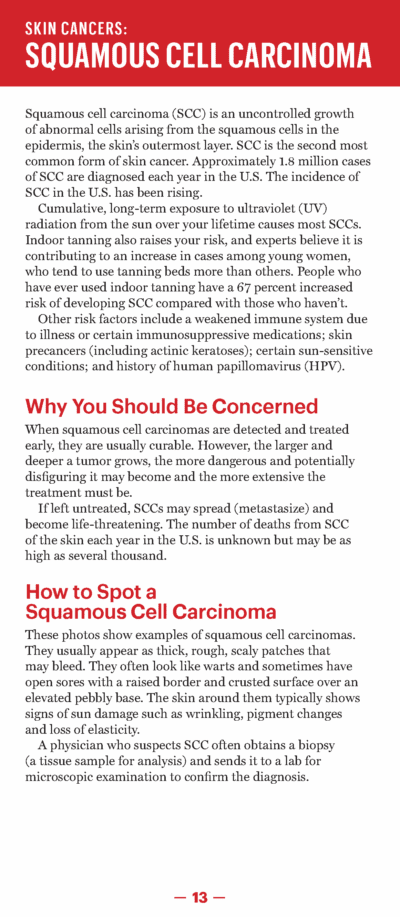 A Guide to Skin Cancers and Precancers