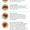 A Guide to Skin Cancers and Precancers
