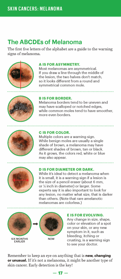 A Guide to Skin Cancers and Precancers