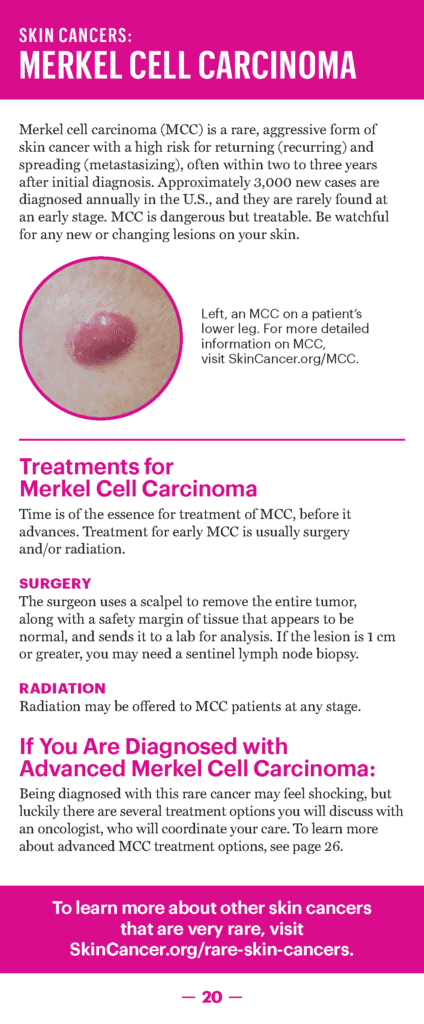 A Guide to Skin Cancers & Precancers – The Skin Cancer Foundation