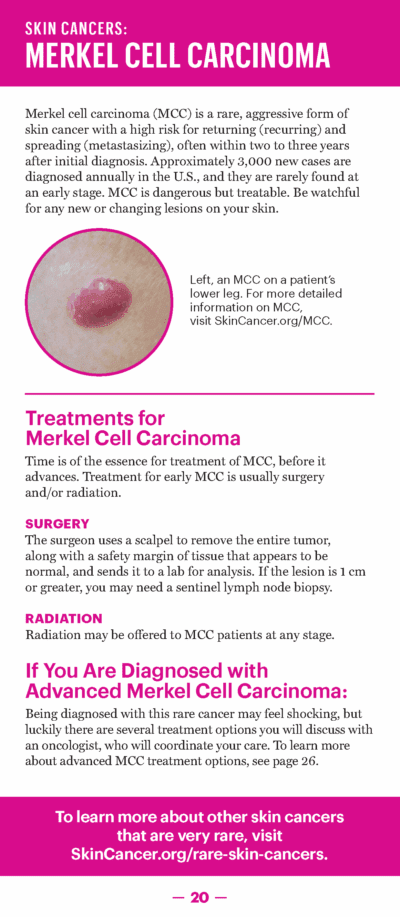 A Guide to Skin Cancers and Precancers